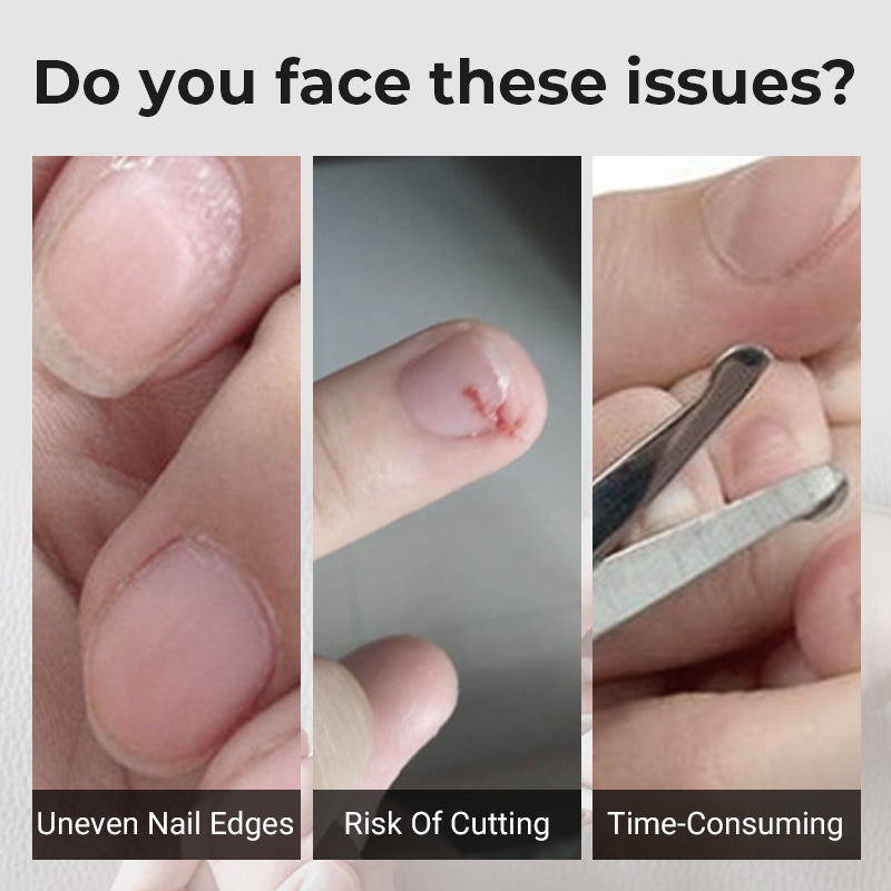 💅 50% OFF NOW! 🔧 3-in-1 Automatic Nail Clipper – Electric Trimming, Polishing & Safe for All Ages ⚡