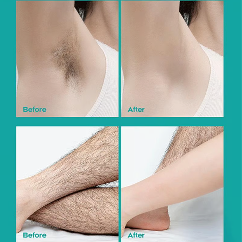 💎 -50% ON PAINLESS HAIR REMOVAL CREAM! 💎 Fast 8-Min Formula for Men & Women, Infused with Aloe & Vitamin E