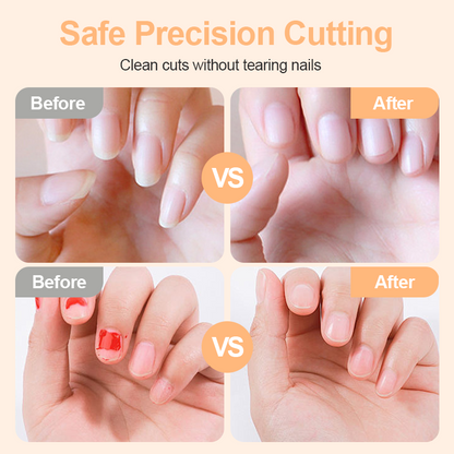 ⏳Limited-time special⏰Electric nail clipper with light💅
