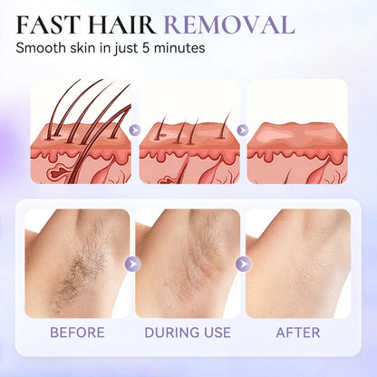 🥳2026 HOT SALE🥳💞50K+ SOLD!💚🌸 Gentle Hair Removal, Zero Discomfort! Natural Cream for Smooth Skin – 50% OFF! ✨🌿