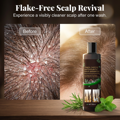 Plant Extract Anti-Dandruff & Itch Relief Shampoo