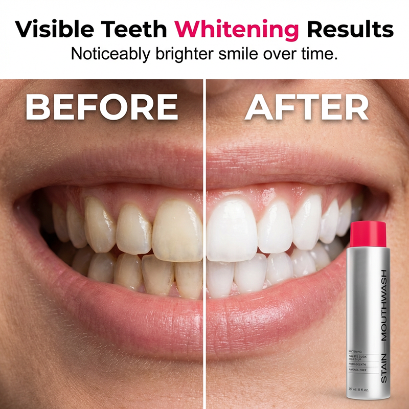 🥳2026 HOT SALE🥳💞50K+ SOLD!😁✨ 50% OFF! Stain‑Removing Whitening Mouthwash – Lifts coffee & tea stains, alcohol‑free. Instant gunk binding, long‑lasting minty fresh. Gentle enough for daily use. 🦷💙